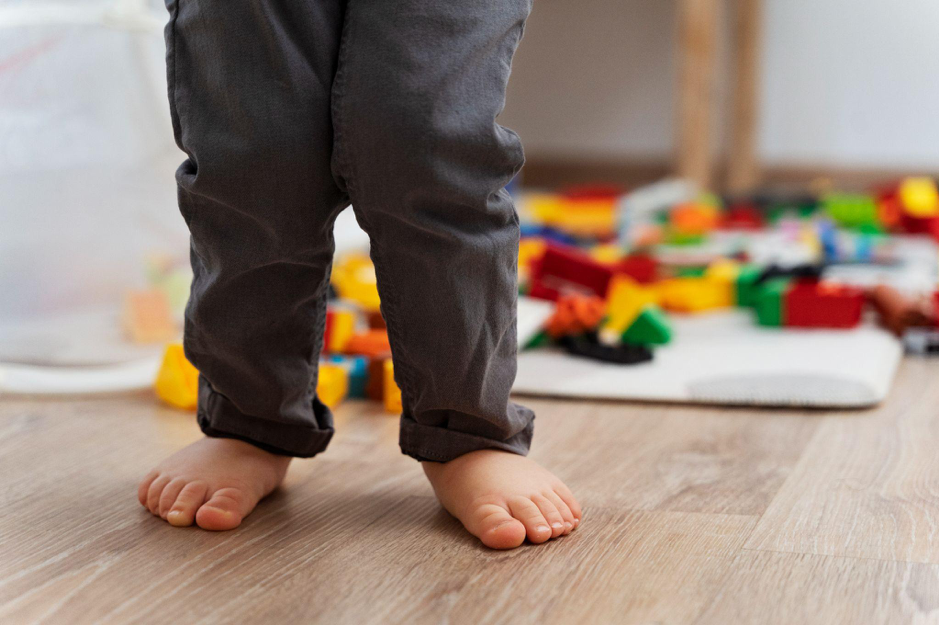 piede piatto idiopatico bambino che cammina